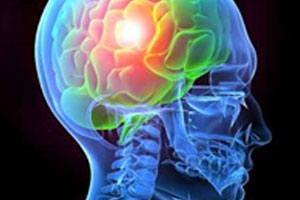 Neurology