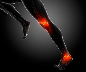 Joint Pain Joint Pain
